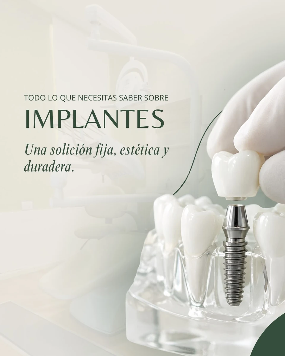 Publicación de B-Clinical Córdoba sobre evaluación y planificación de implantes odontológicos